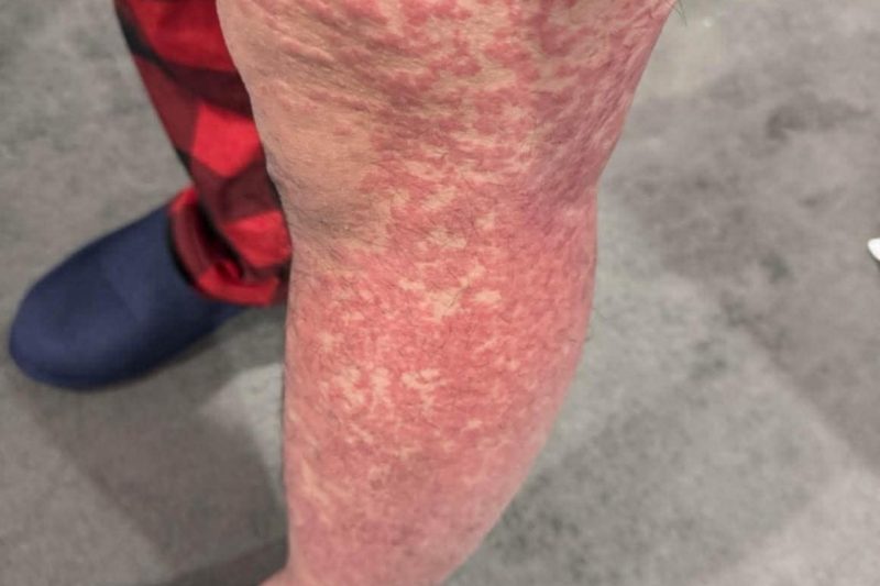 These are the consequences of sleeping with…See more