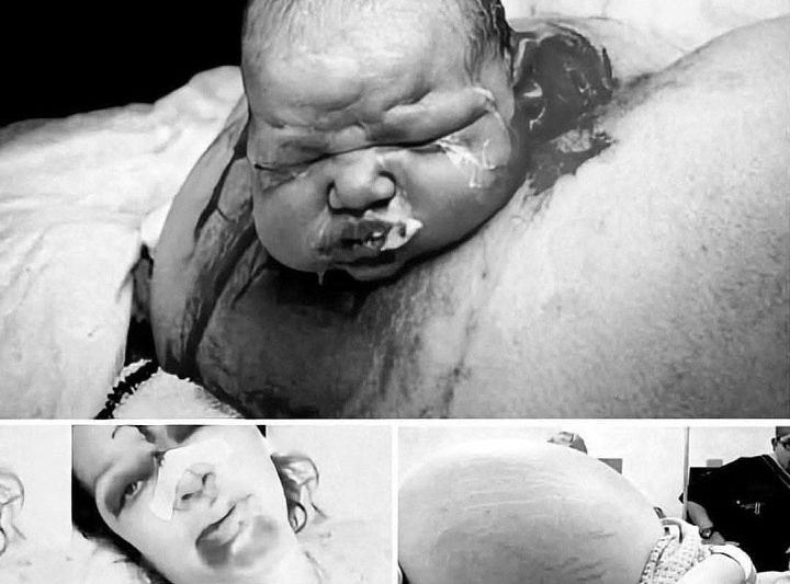 SHE WENT INTO LABOR—BUT WHAT DOCTORS PULLED OUT LEFT THE WHOLE ROOM GASPING (It Wasn’t a Baby!)