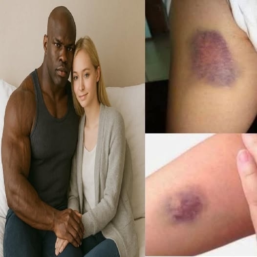 Young woman was hospitalized after being penetrated…See more  